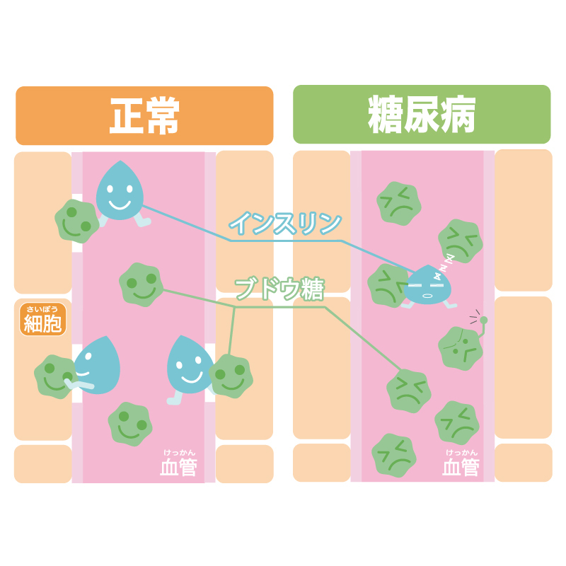 インフルエンザ予防接種