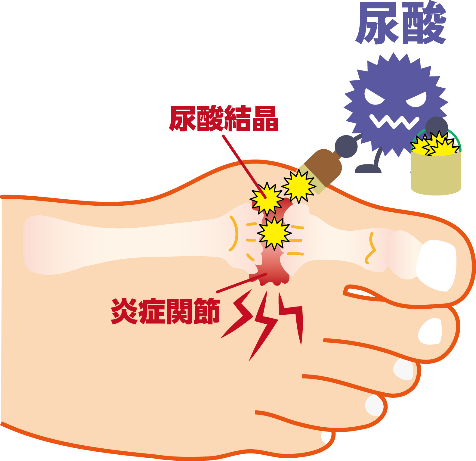 インフルエンザ予防接種